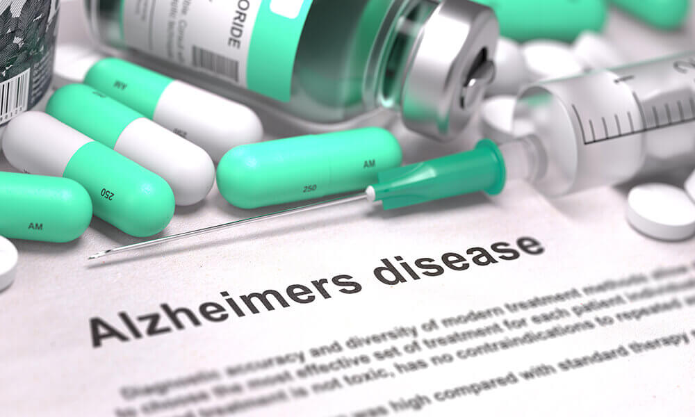 alzheimers disease